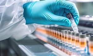 中国矿产行业发展前景及现状分析2023 长期来看矿业持续向好的基础比较坚实(图7)